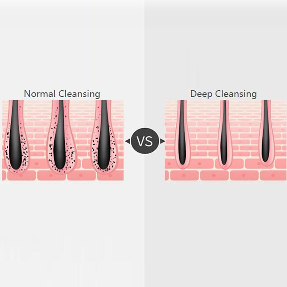 Bomidi FC1 Electric Facial Cleanser Brush With Stand Soft Bristle 8 Speed Level Vibration Deep Cleaning Brush Rechargeable USB Cable - Pink